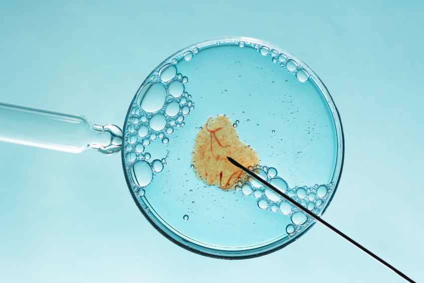 Intrauterine Insemination (IUI) procedure by Dr. Sravani Reddy at Vedika Clinic